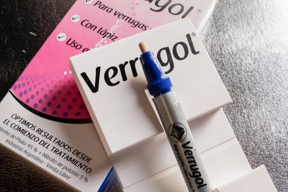 ANMAT prohibió un medicamento para tratar callos y verrugas